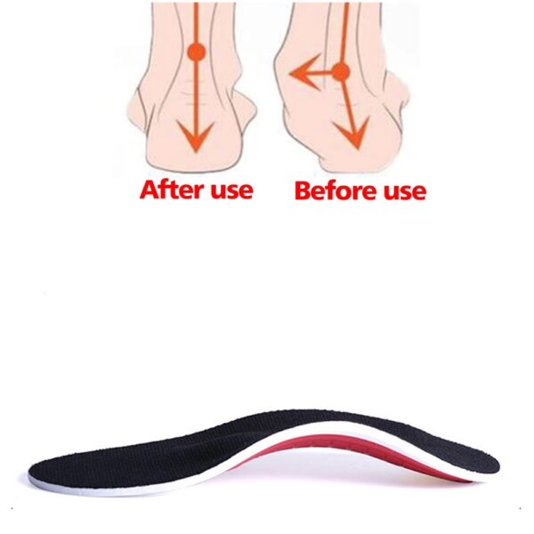 Flat Foot Correction Insoles – Image 3